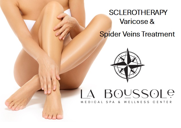 VARICOSE AND SPIDER VEINS SCLEROTHERAPY TREATMENT at La Boussole